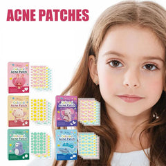 144 PCS Acne Pimple Patches - Invisible, Colorful Skin Care Stickers for Blemish Concealing