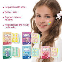 144 PCS Acne Pimple Patches - Invisible, Colorful Skin Care Stickers for Blemish Concealing