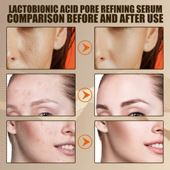 Lactobionic Acid Pore Shrinking Fine Repair