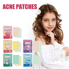 144 PCS Acne Pimple Patches - Invisible, Colorful Skin Care Stickers for Blemish Concealing